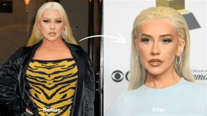 Has Christina Aguilera Had Plastic Surgery? Comparing Christina Aguilera's Appearance Before and After - SarkariResult