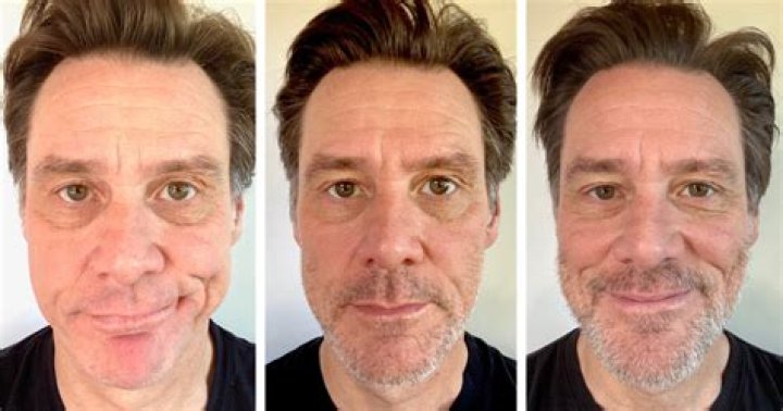 James Lock's Facial Changes- What Happened to His Face? Introduction to James Lock- Who is He? - SarkariResult