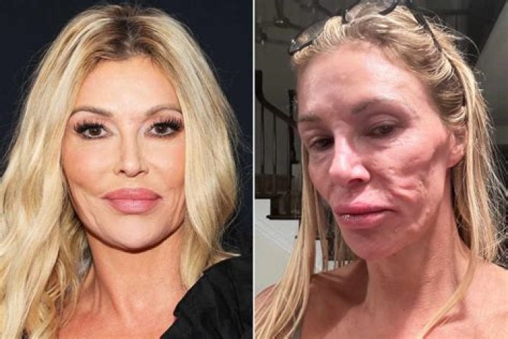What Happened To Brandi Glanville’s Face? Has She Done Plastic Surgery