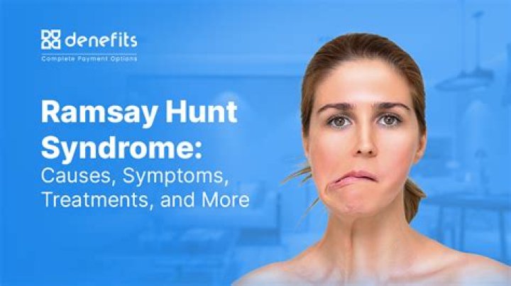 What Illness Does Tony Horton Has? Health Update, Ramsay Hunt Syndrome Explained